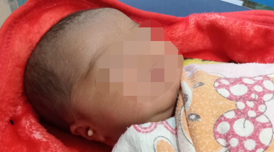 Bayi Malang Mengalami Demam, Polisi Kumpulkan Bukti Kejar Pelaku Pembuangan Bayi
