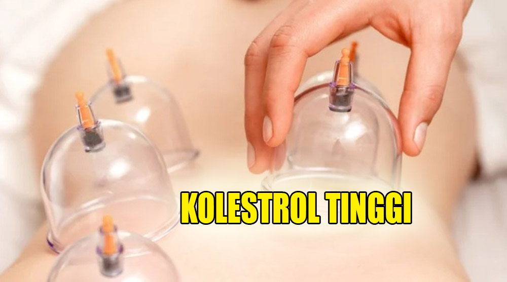 Panik Kolesterol Tinggi, Jangan Risau Simak Baik-Baik Solusi Ini