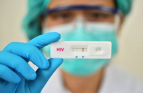Semua Orang Beresiko Segera Kenali Gejala HIV AIDS Sejak Dini 