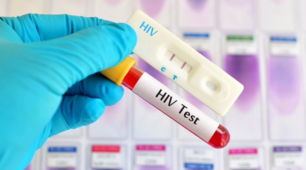 Ternyata Ada Banyak Tes Untuk Mendeteksi Virus HIV, Ini Penjelasannya!