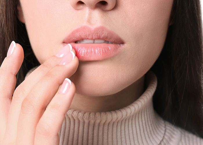 6 Tips Menghindari Bibir Kering dan Pecah-pecah Saat Berpuasa