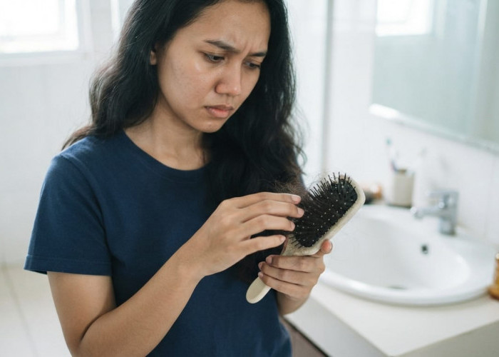Rambut Rontok, Ini Penyebab dan Cara Mengatasinya