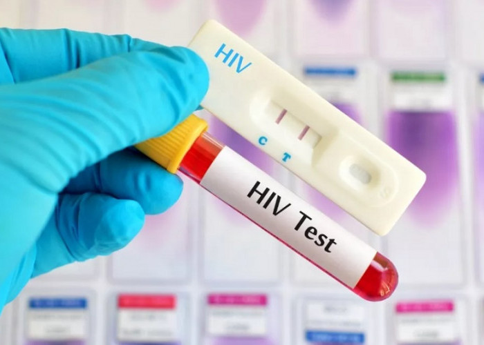 Ternyata Ada Banyak Tes Untuk Mendeteksi Virus HIV, Ini Penjelasannya!