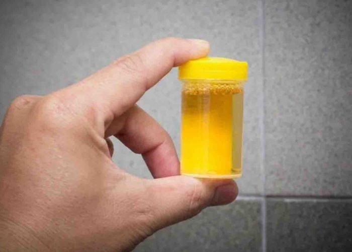 Terapi Urine Membuat Cantik dan Sehat. Mitos atau Fakta ?
