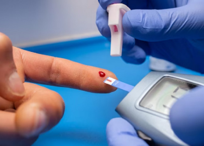 Kenali Ciri-Ciri dan Cara Mengatasi Kadar Gula Darah yang Tinggi Bagi Penderita Diabetes