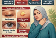 Sering Dianggap Sepele, Yuk Kenali Ciri Kolesterol Tinggi