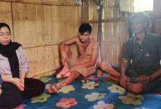 Kondisi Korban Luka Bakar Akibat Sengatan Listrik Makin Parah, PLN dan Kapolres Turun Tangan!