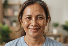 Sunscreen untuk Kulit Kering, Rahasia Flek Hitam Memudar